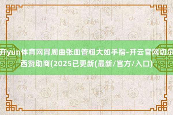 开yun体育网胃周曲张血管粗大如手指-开云官网切尔西赞助商(2025已更新(最新/官方/入口)